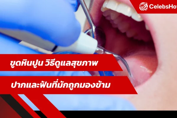 ขูดหินปูน วิธีดูแลสุขภาพปากและฟันที่มักถูกมองข้าม